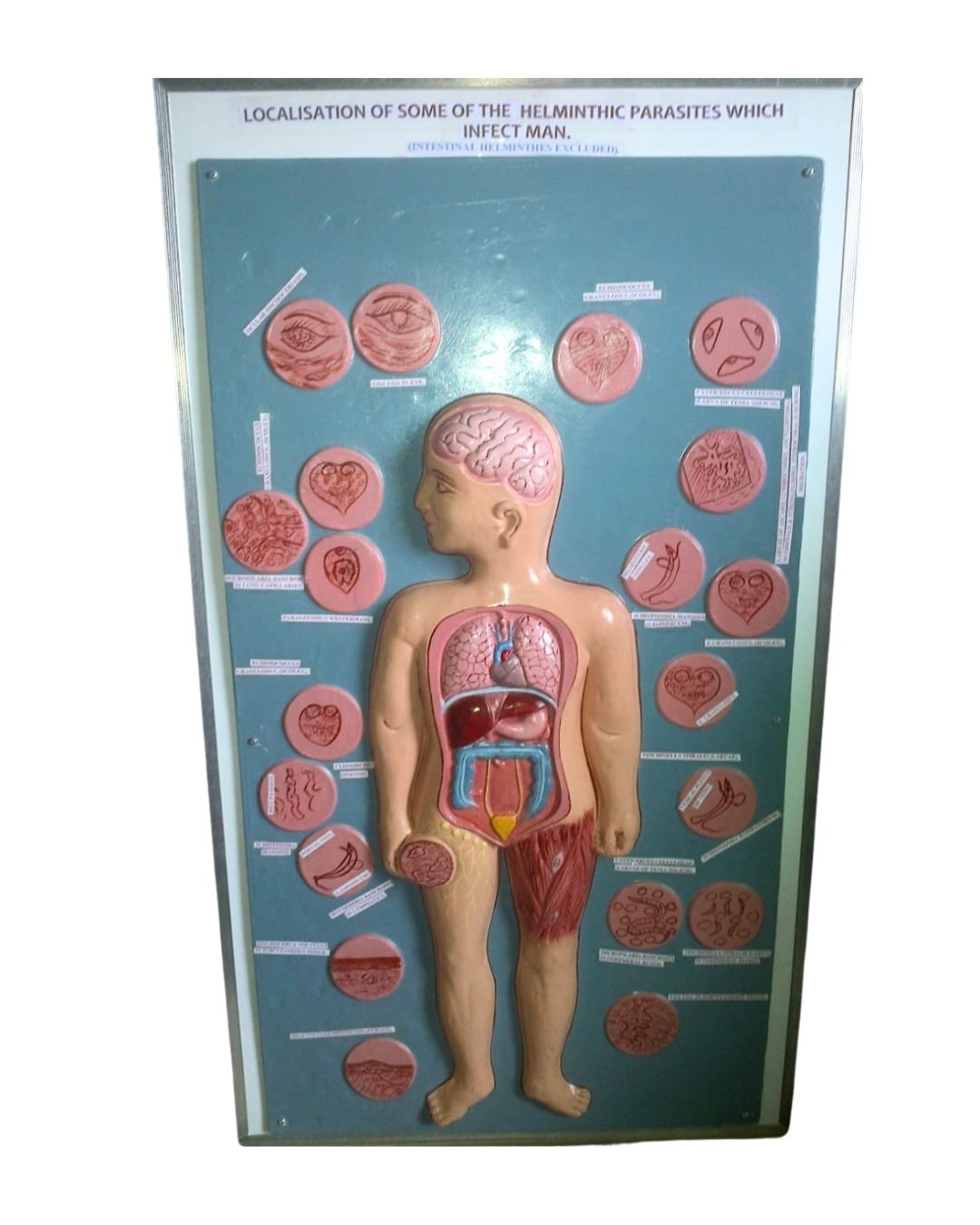 Localisation of Helminthic Parasites in Humans