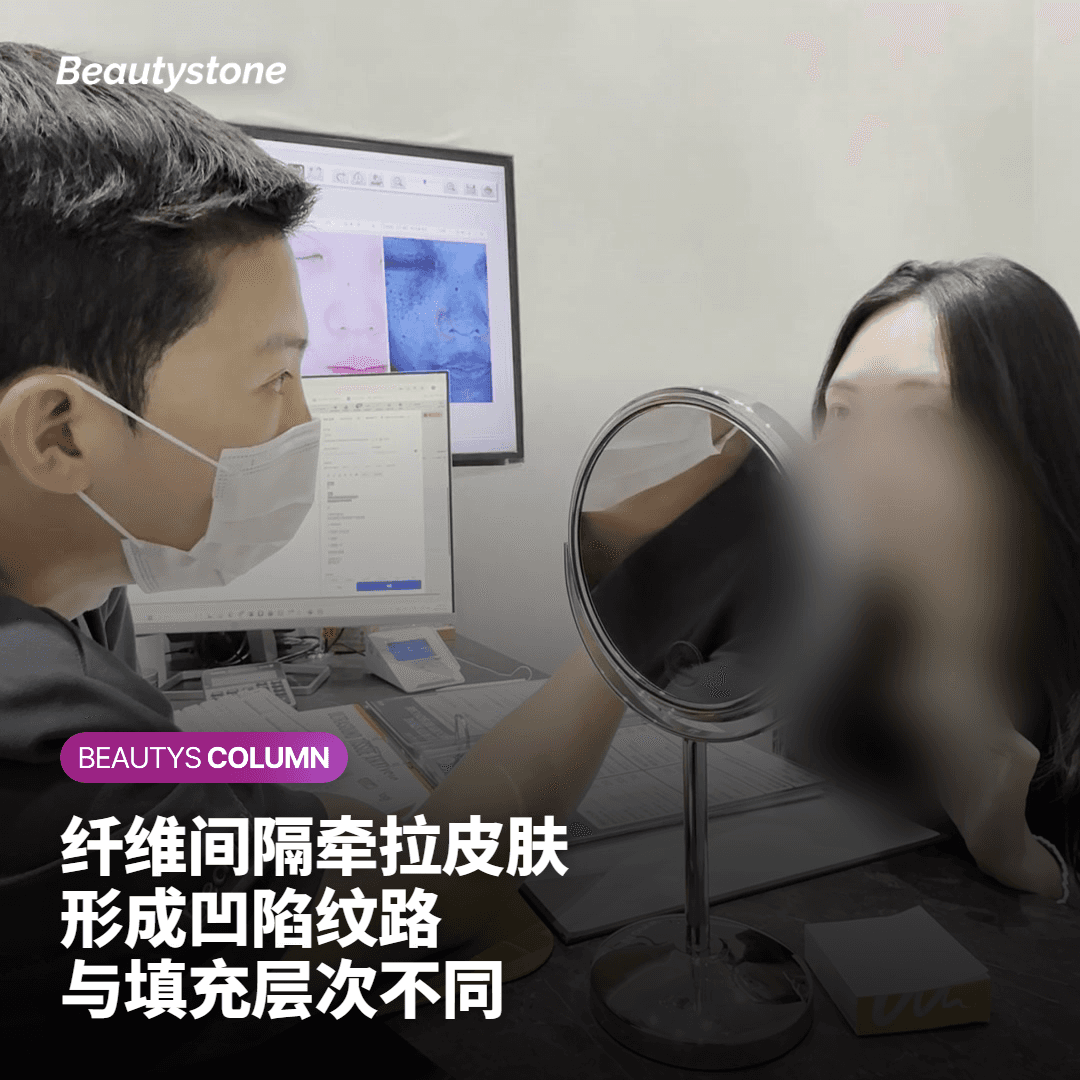 橘皮纹是如何形成的？