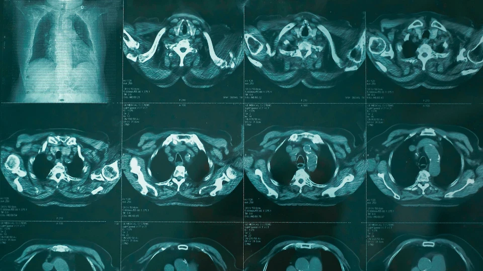 Chest scan imagery