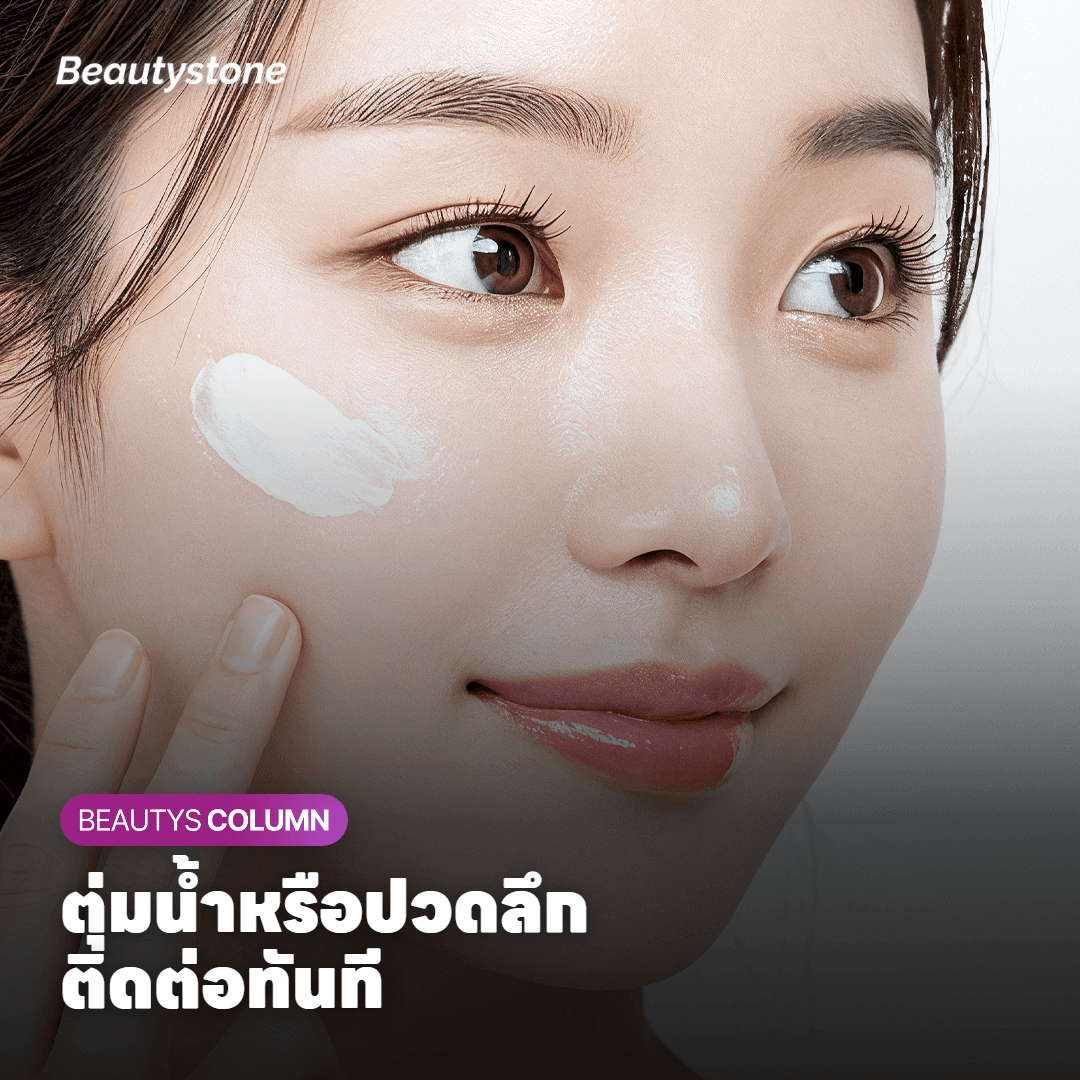 การวางแผนจำนวนครั้งและระยะห่างของ Onda Lifting