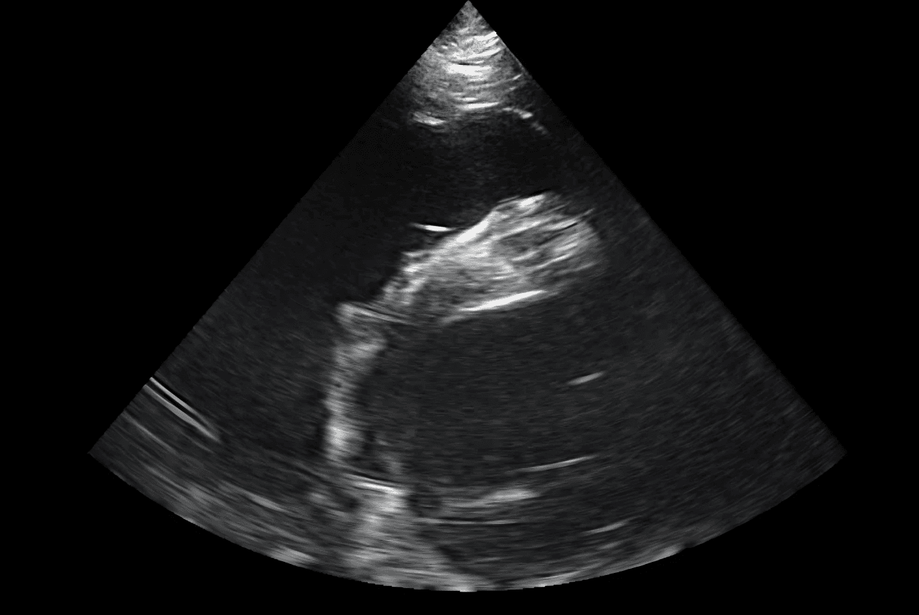 Ultrasound image 