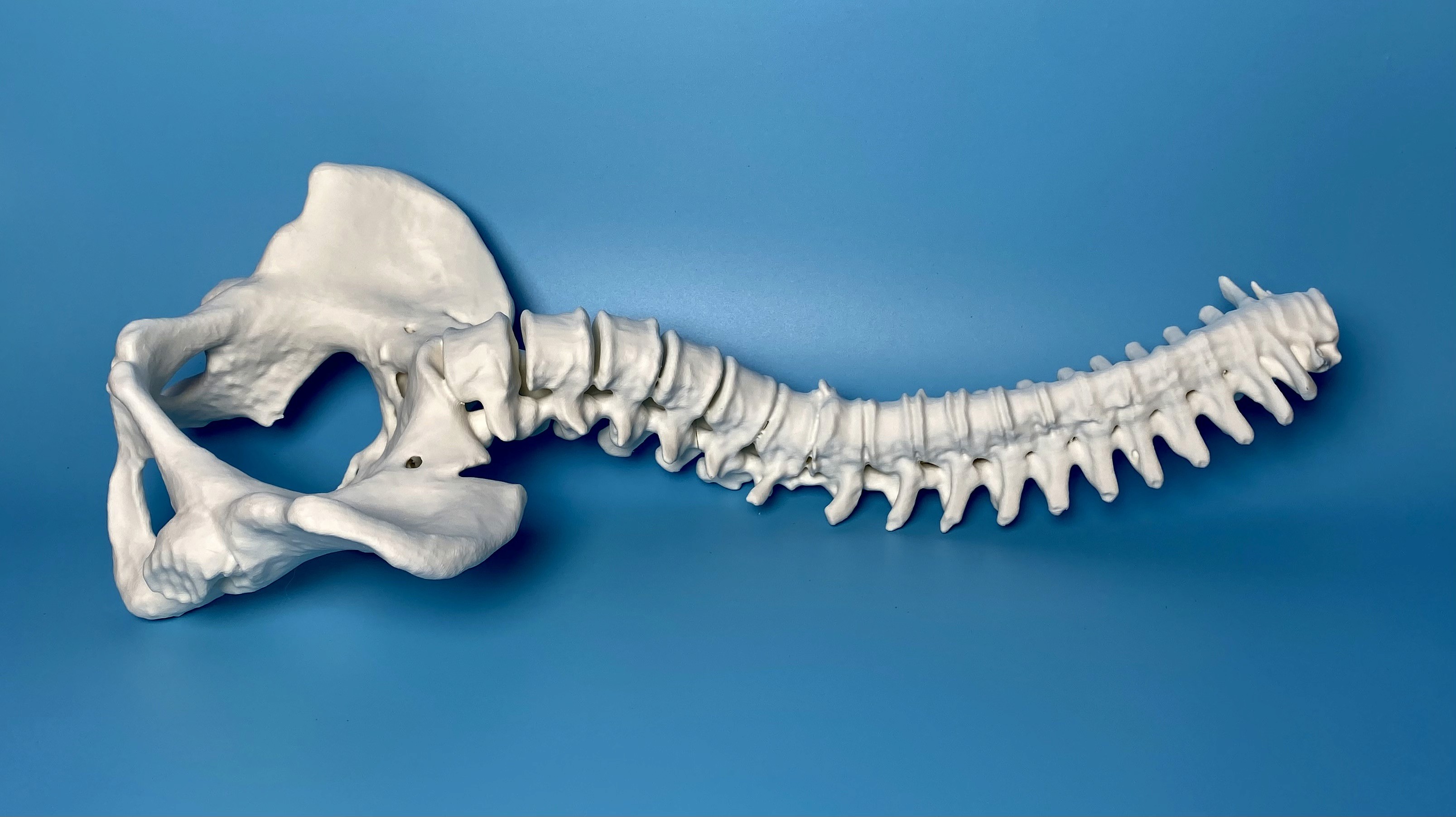 3d printed spine pelvis white polyterra pla scoliosis