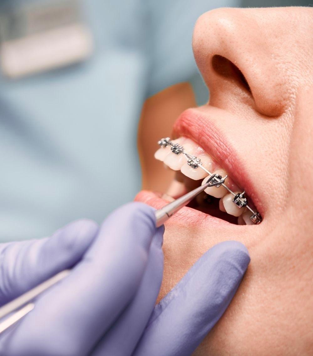 woman in blue tube dress smiling