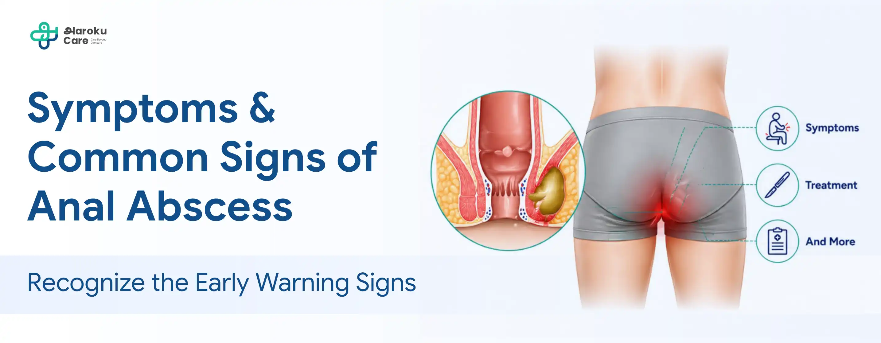 Symptoms & Common Signs of Anal Abscess