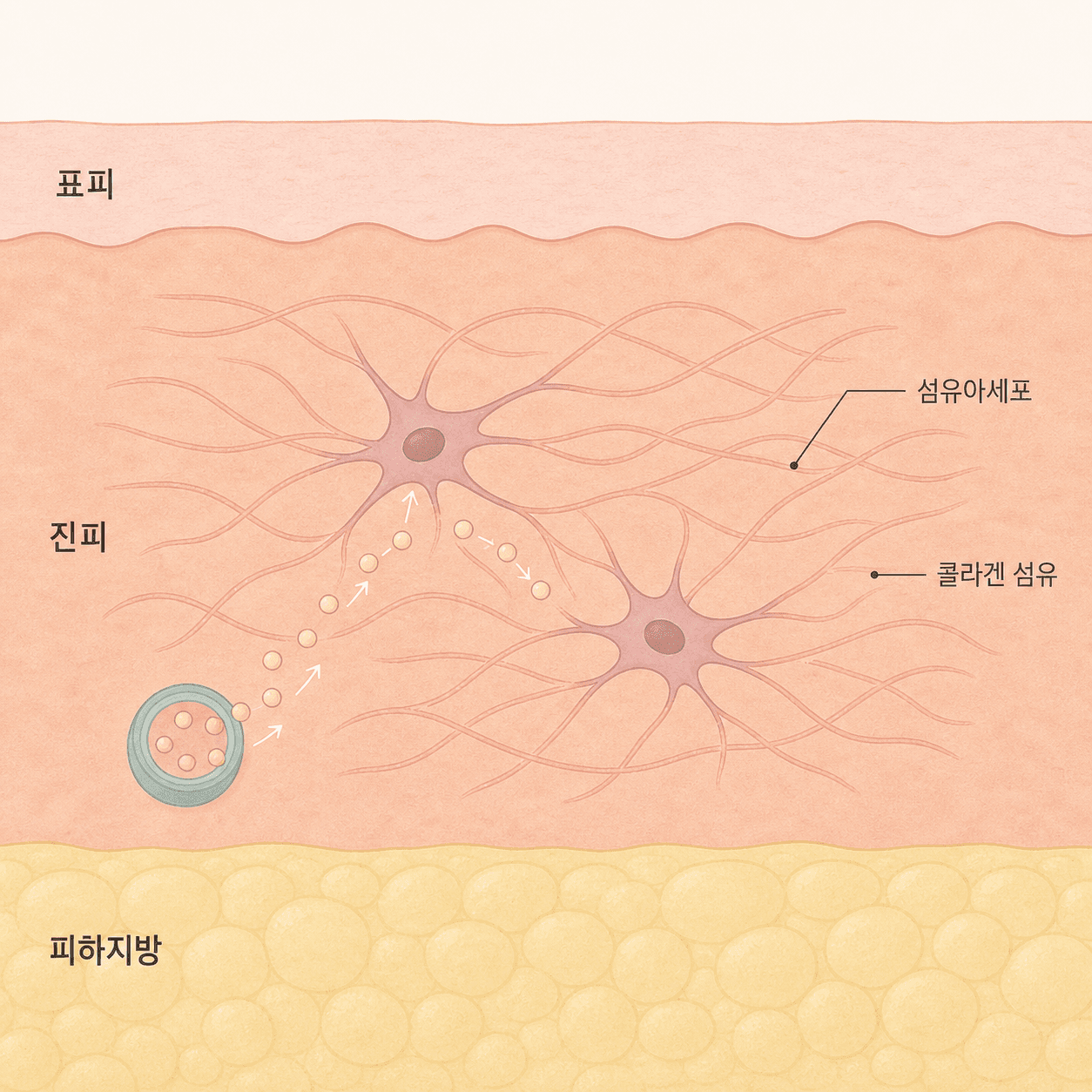섬유아세포가 재료를 받아 콜라겐을 짓는 자리