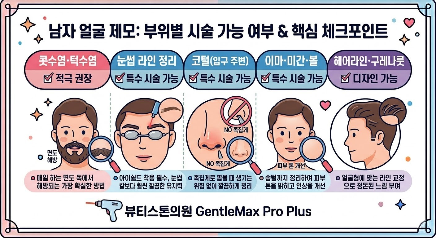 남자 얼굴 제모 가능 부위   — 수염·이마·미간·헤어라인 구역 구분