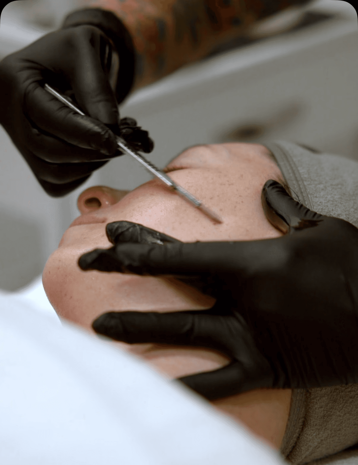 Close-up of Matsuju applying precision skincare with gloved hands during a facial procedure.