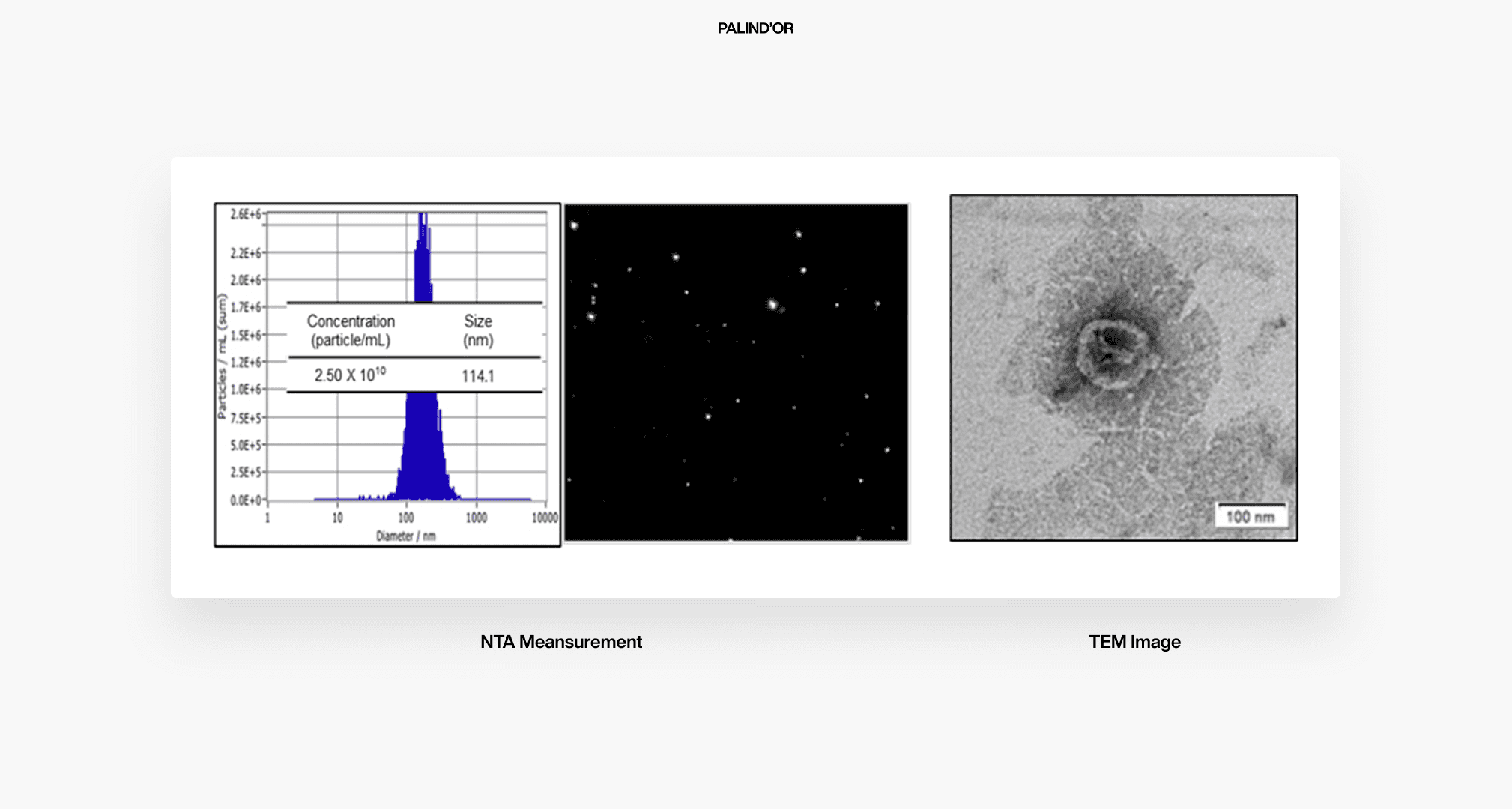 Tecnologia da Microscopia TEM da parceira da PALIND'OR a GFC para validaçaõ dos exossomos