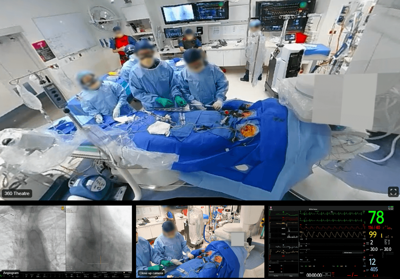 Surgical XR Live Procedure