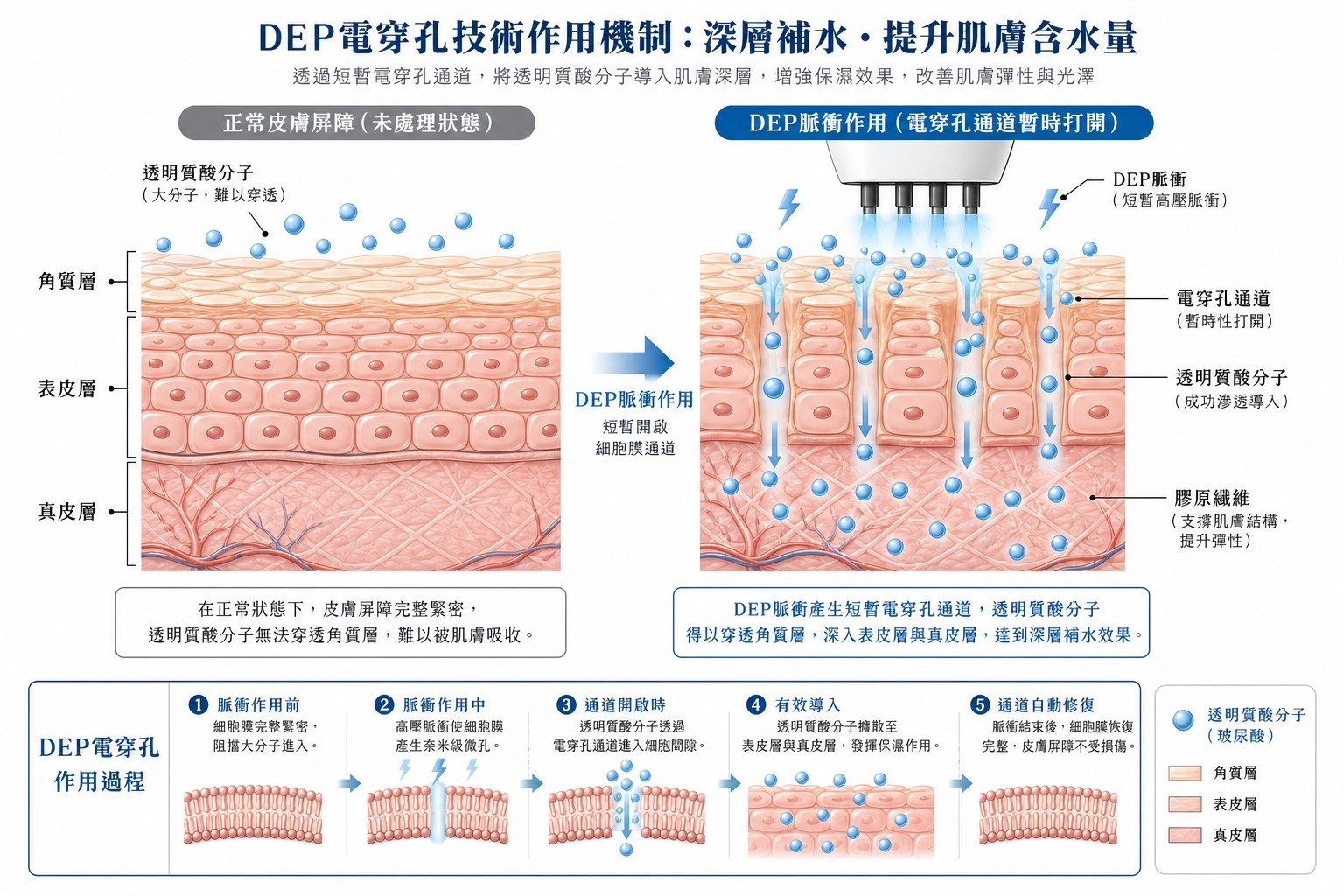 無針 DEP 水光導入技術 | 尖沙咀 Attitude Beauty – 先進無針微電流技術,深層導入精華,零針頭零修復期How DEP needle-free infusion works – microcurrent technology delivering active ingredients into the dermis