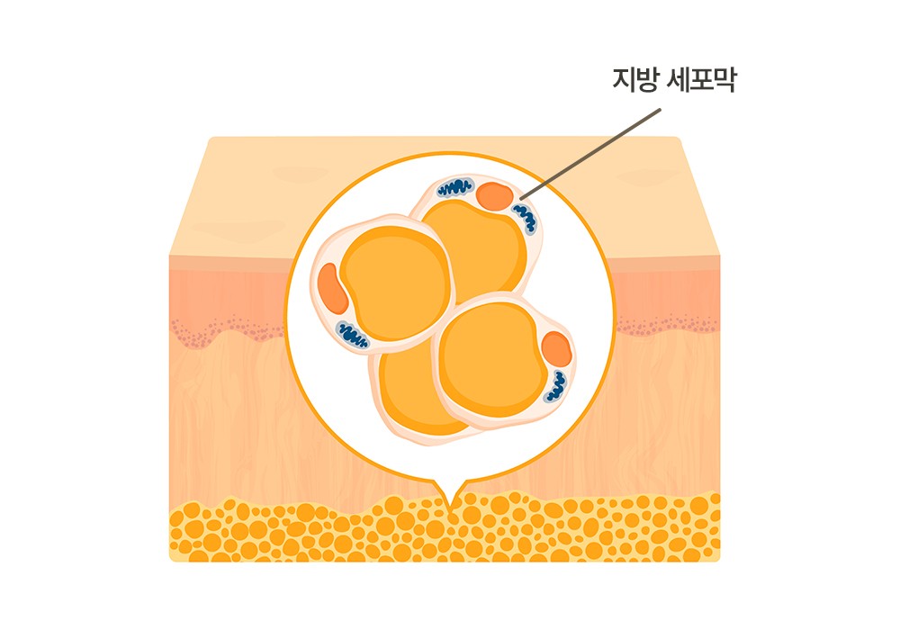 fat cell destroying treatments fat dissolving injections