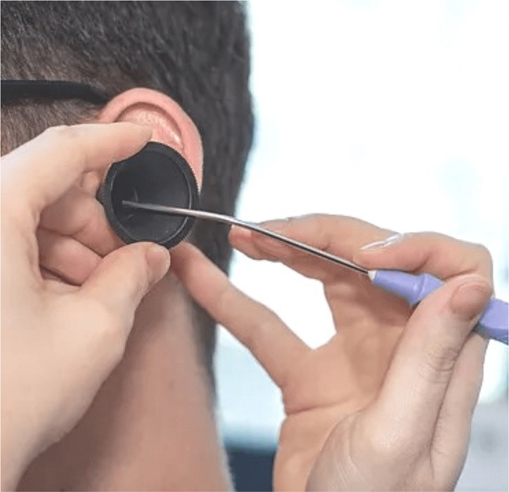 Microsuction ear cleaning.