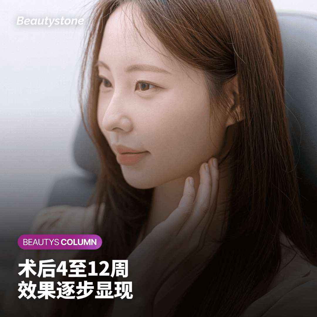 婚礼前多久做比较合适？