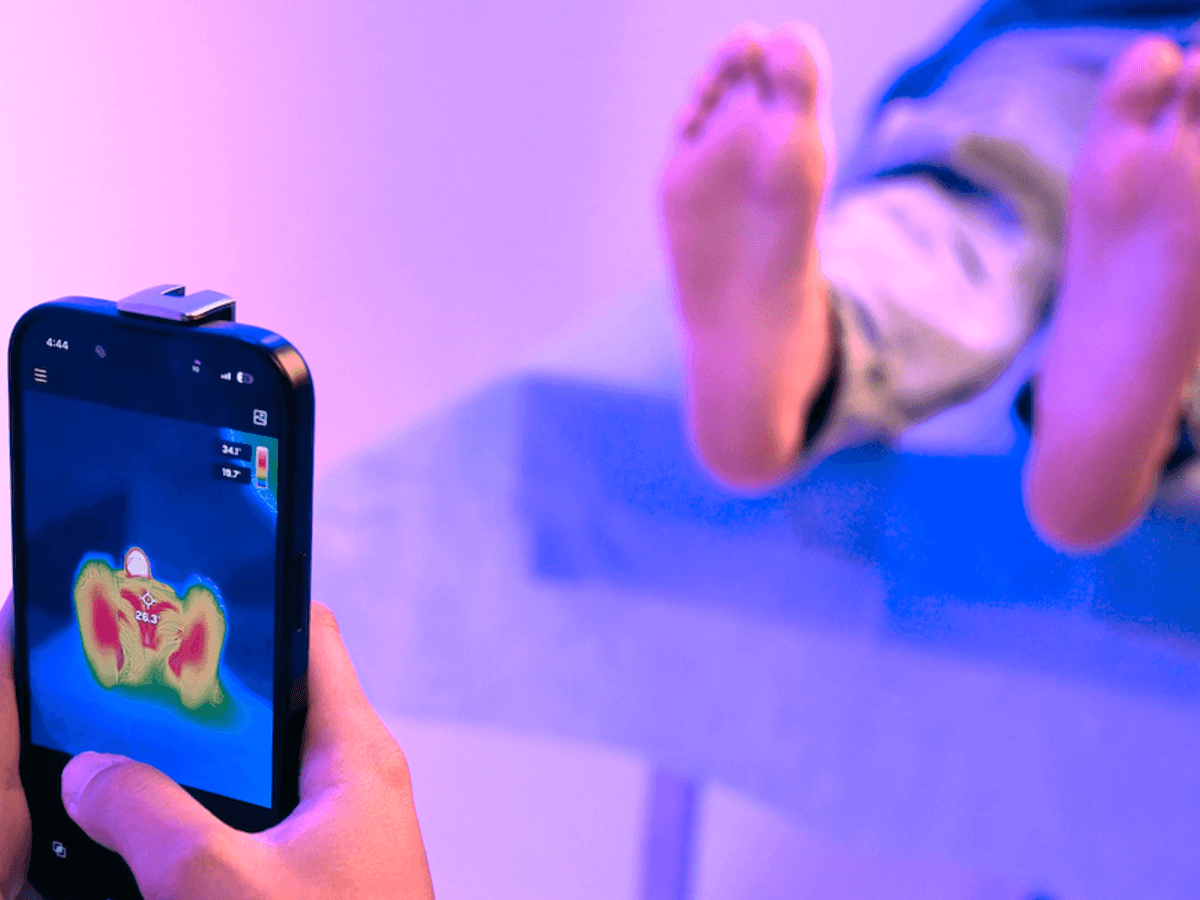 Amplifai Thermal Imaging