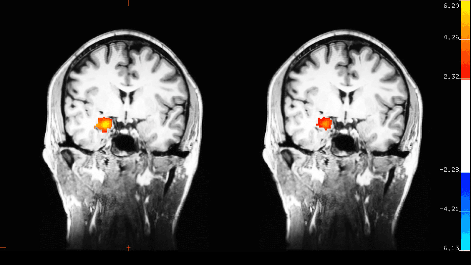 You Are Not Your Mind: The Power of Moving Meditation as a Powerful Ally