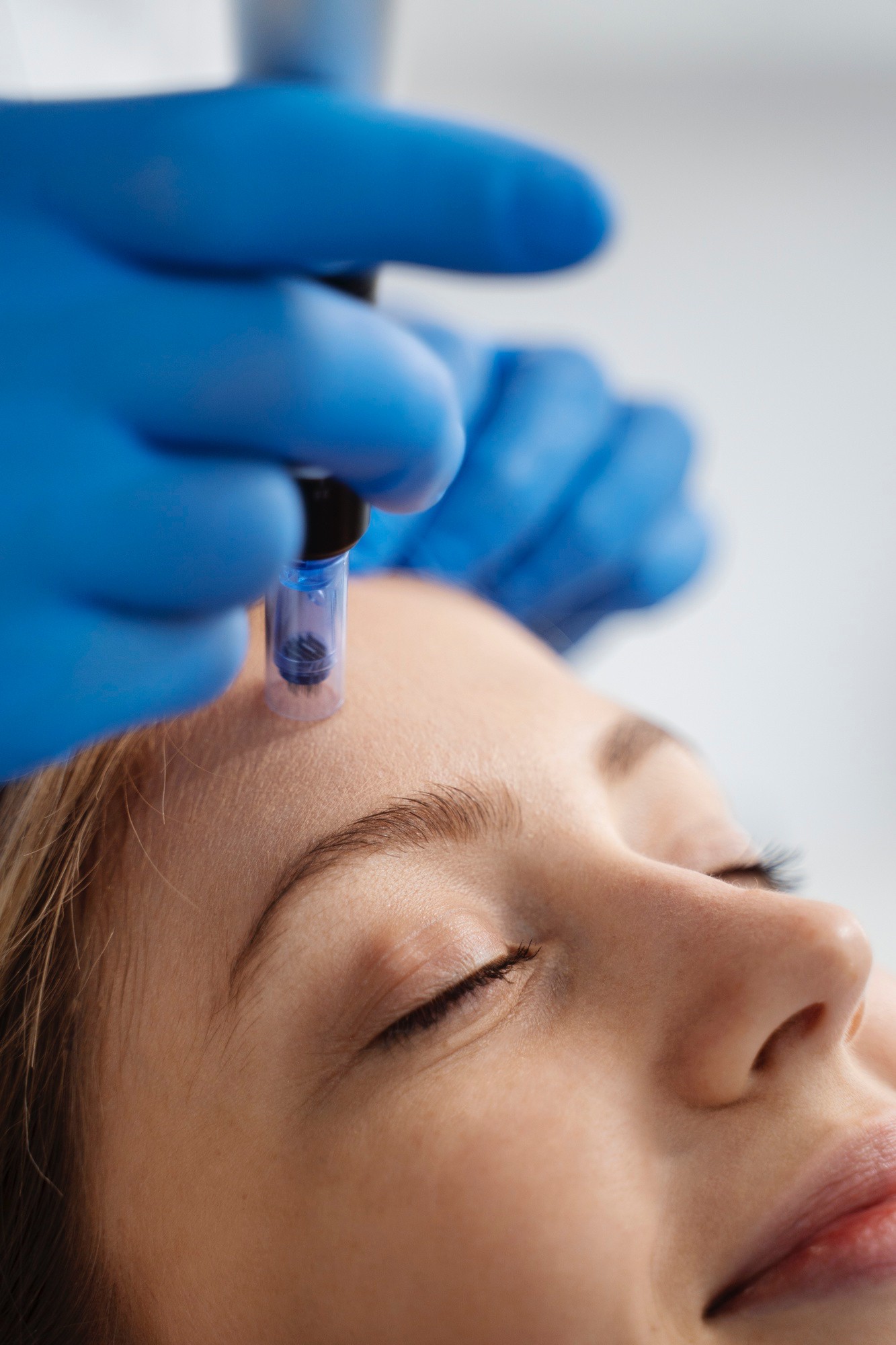 Woman getting a Hydrafacial treatment