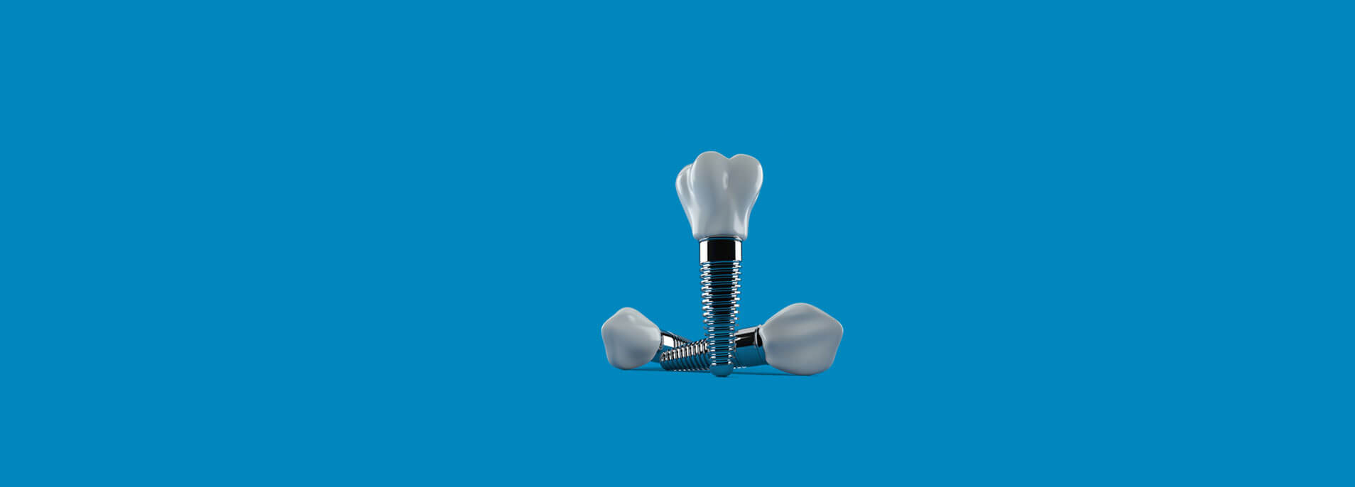 single dental implant
