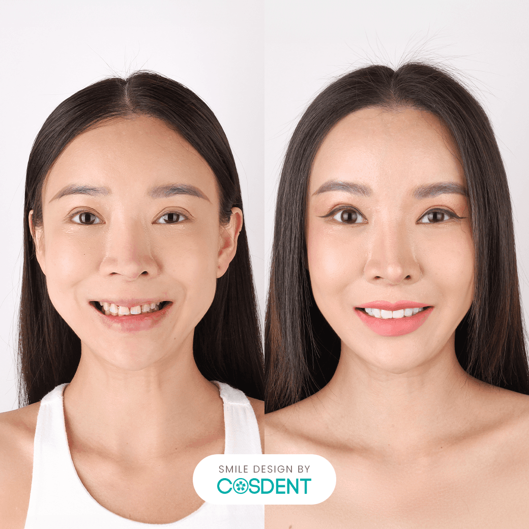 หน้าจีน ยิ้มกว้าง 19 ซี่