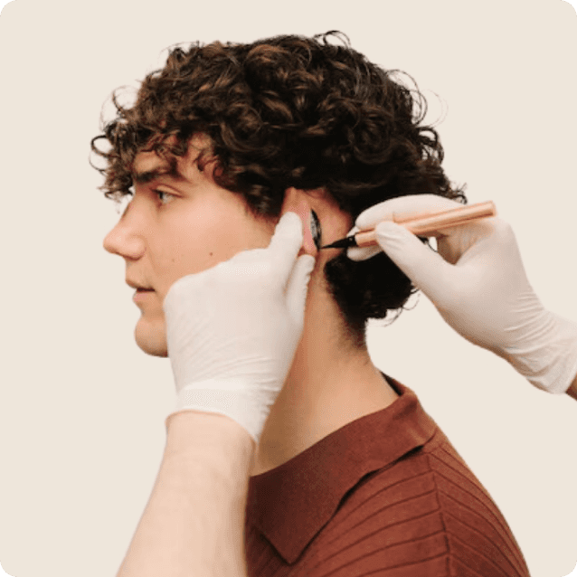 Close-up view of a man's ears before undergoing otoplasty, showcasing prominent ears that protrude from the sides of his head. The man has a neutral expression, and the clinical setting highlights the areas of focus for the ear surgery aimed at reshaping and repositioning the ears for a more balanced appearance.