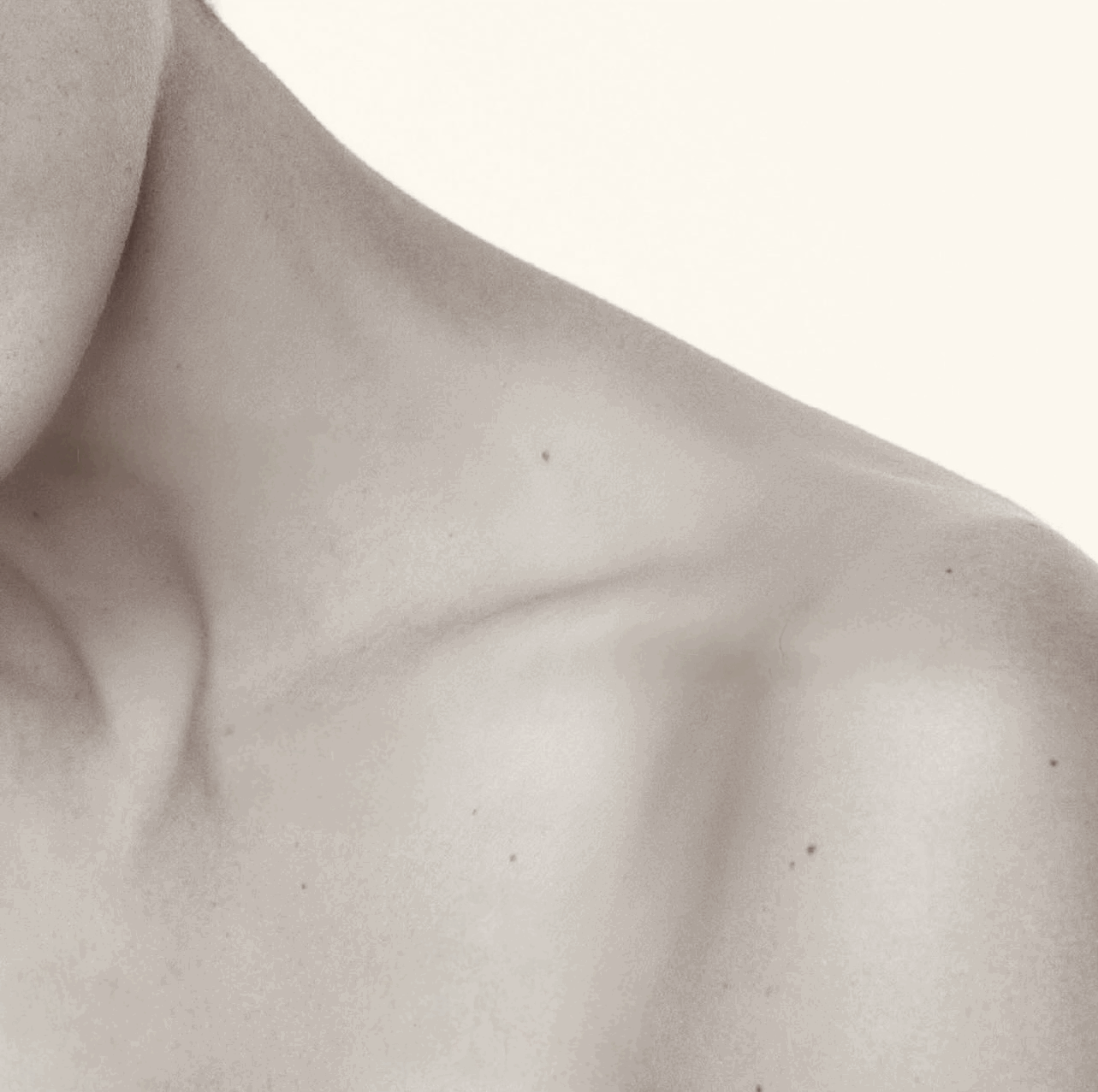 Hauterfirschung nach Skinbooster  Bad Wörishofen Allgäu