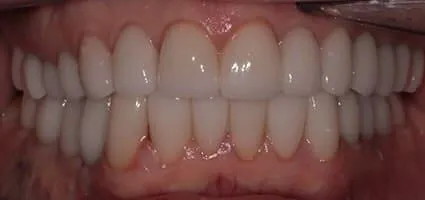 After Image