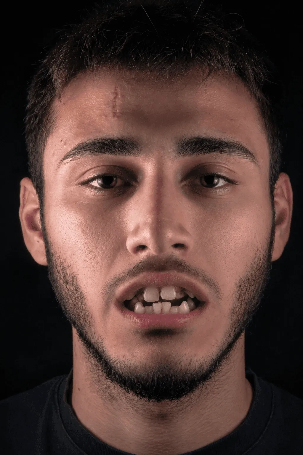 a young man showing teeth