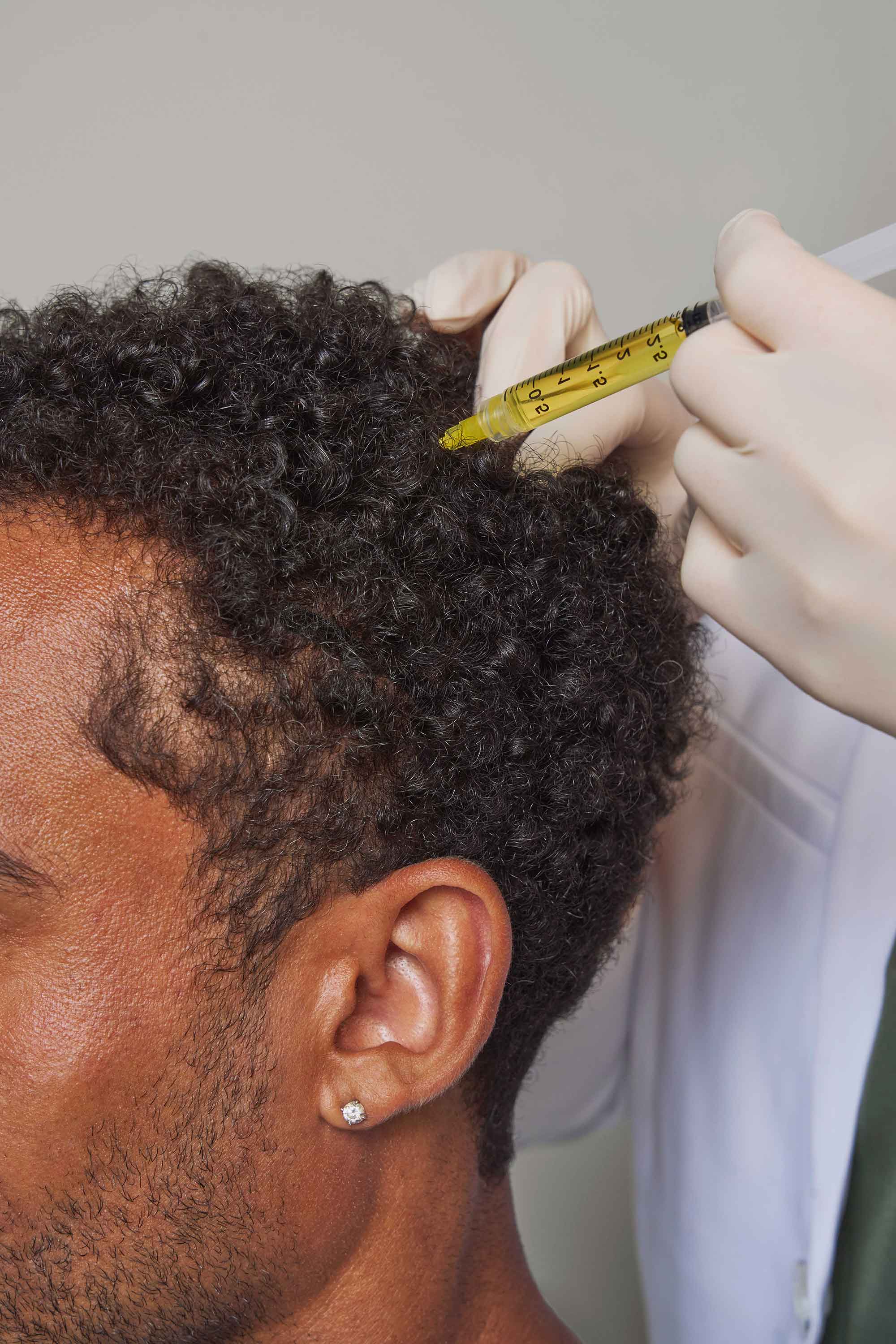 A hair care professional applying a treatment to a client's scalp in a salon setting.