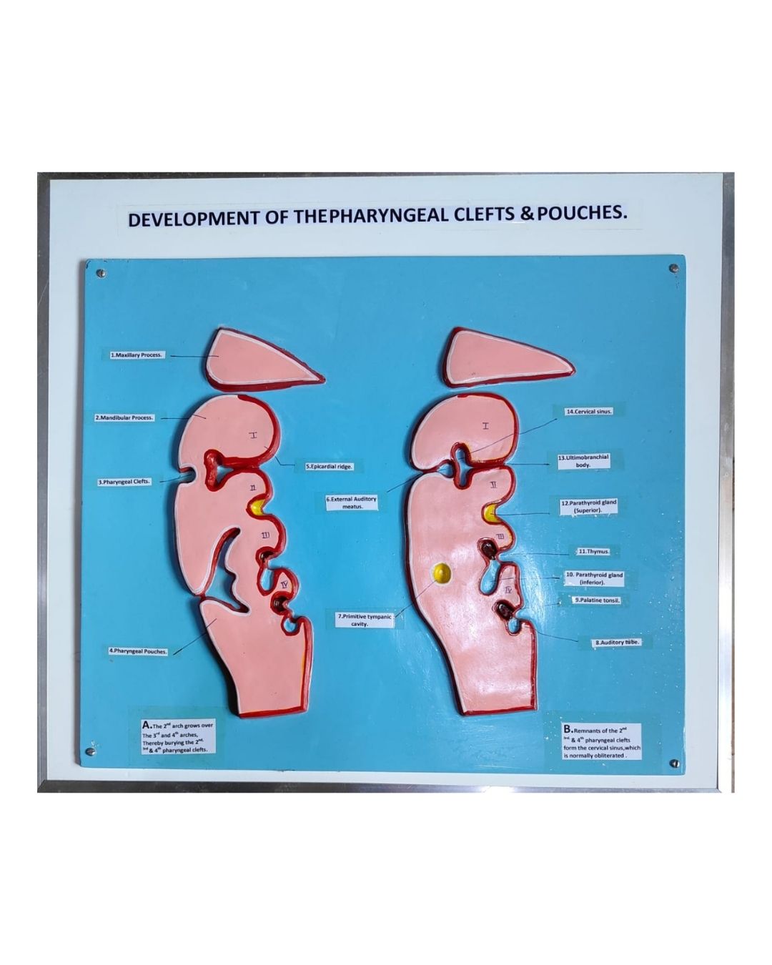 Development of the Pharyngeal Clefts & Pouches