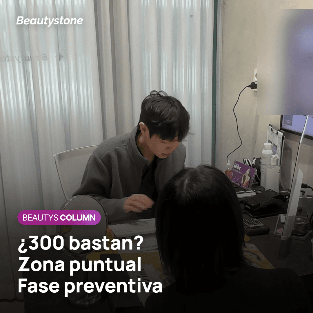 Cuándo bastan 300 disparos: zona acotada y cuidado preventivo