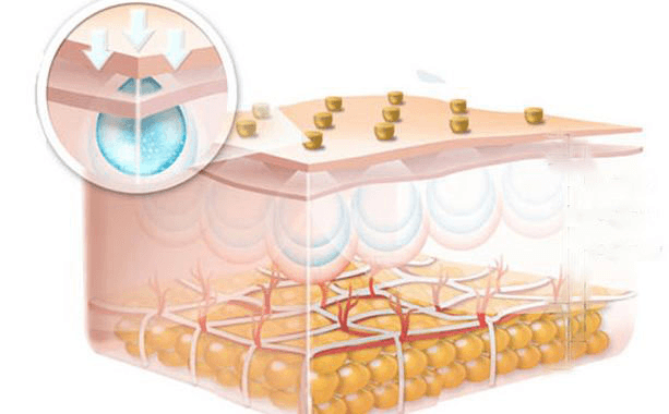 Sodium Hyaluronate Gel vs Hyaluronic Acid Serum — Which Is Better?