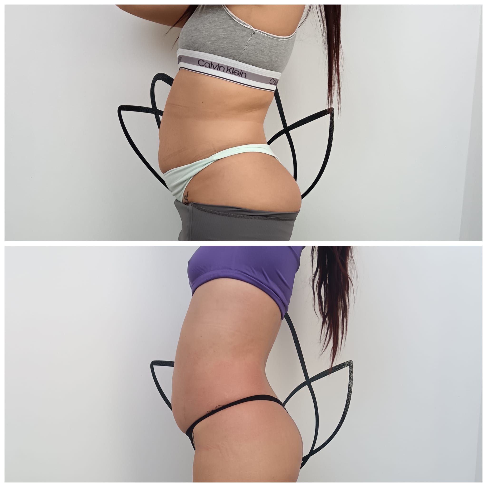 Transformation Photo