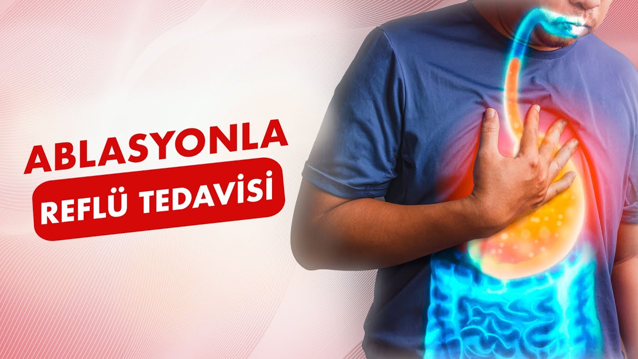 Reflü Şikayetlerinizden 30 Dakikada Kurtulun! Ablasyonla Reflü Tedavisi