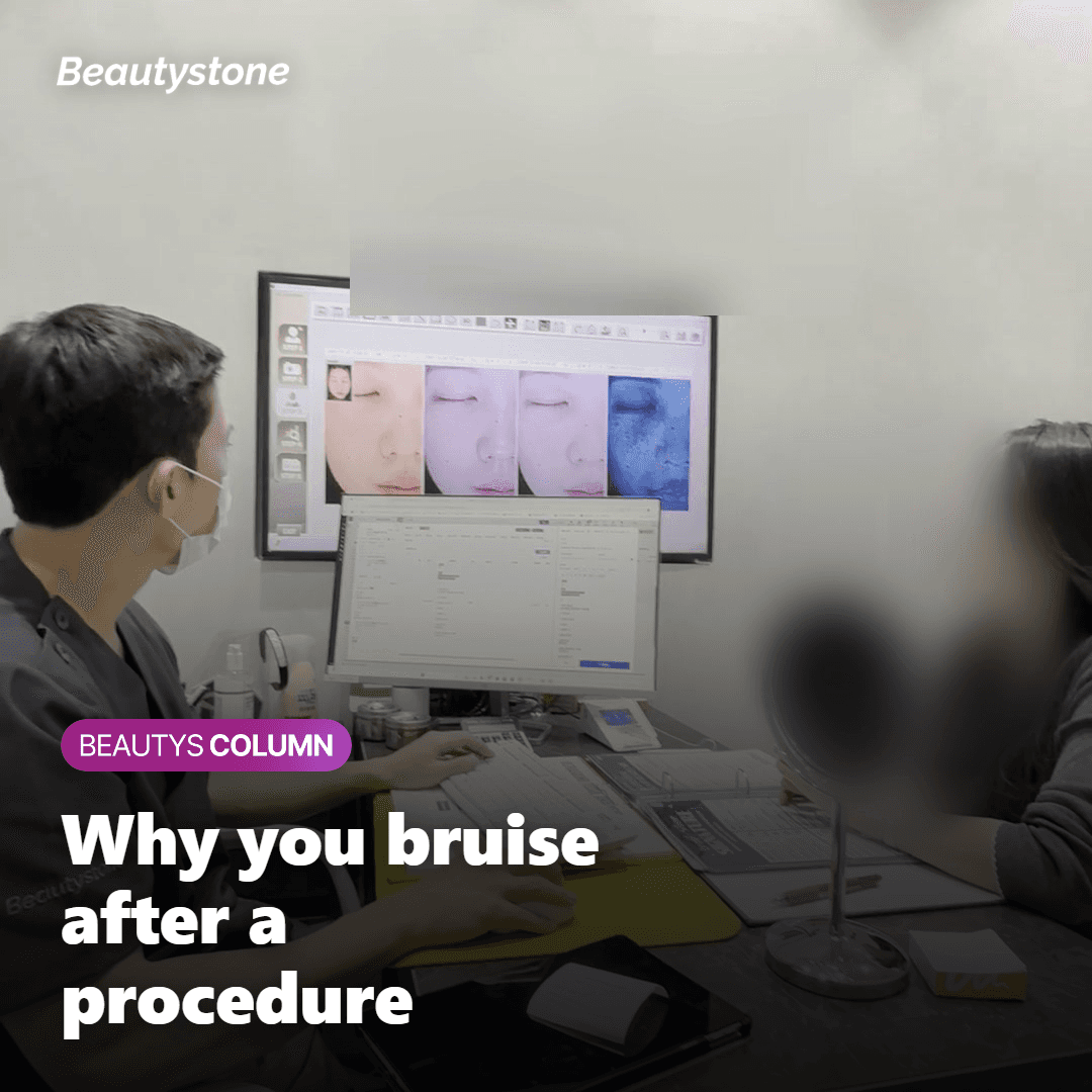 Illustration showing why bruising happens after a procedure