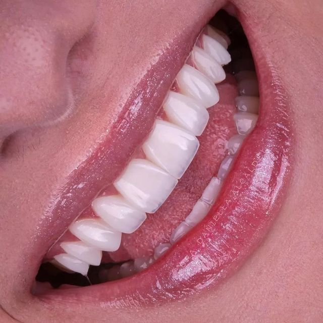 Woman applying skincare on her face