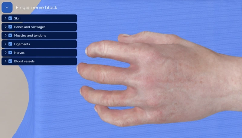 Digital Nerve Block - Finger