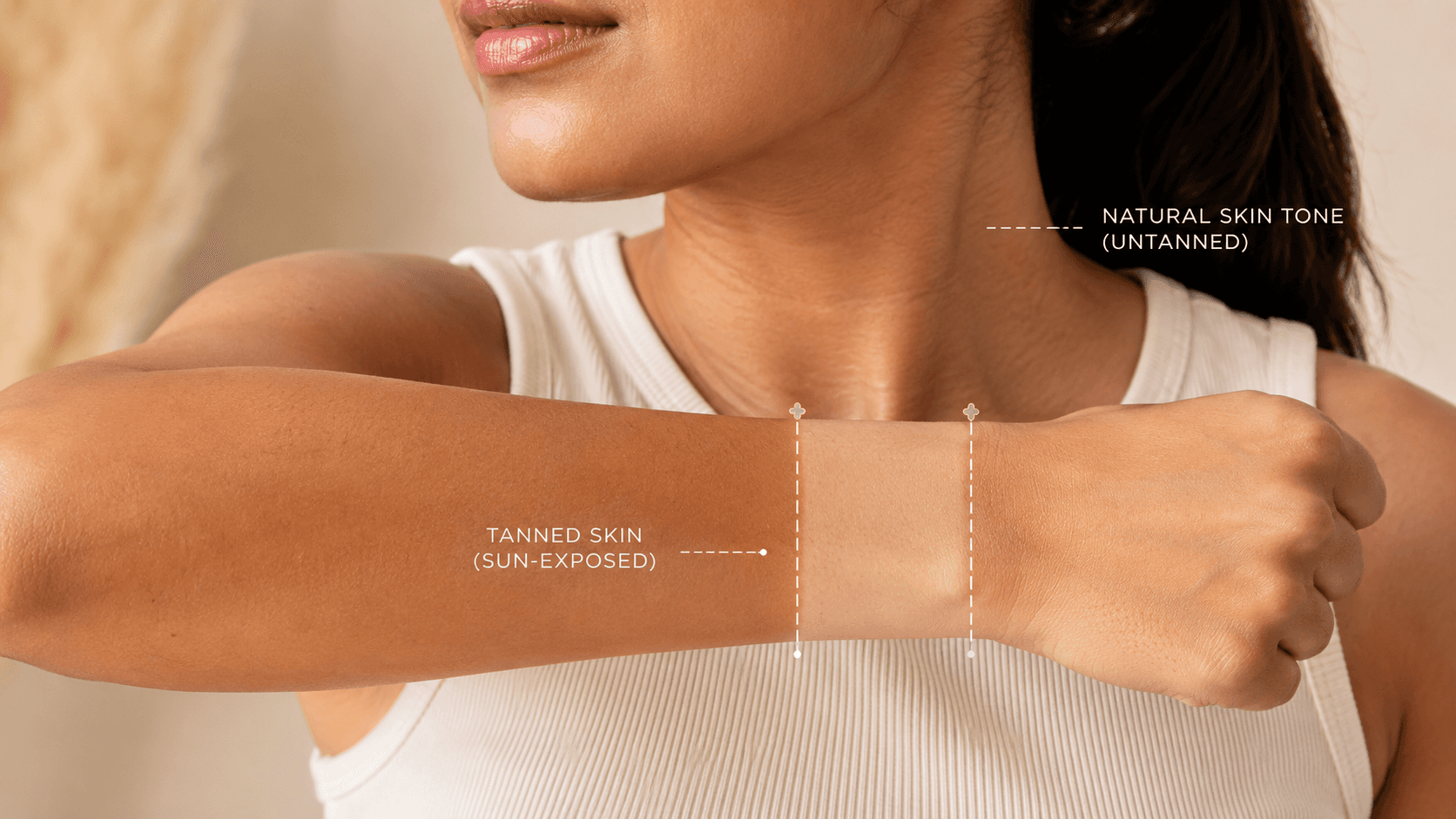 A high-resolution clinical photograph of an Indian individual showing a distinct tan line on the forearm or neck, contrasting a sun-exposed golden-brown area with a naturally lighter skin tone. The lighting is bright and clear to emphasize the difference in skin uniformity. 16:9, aesthetics form the collage earlier