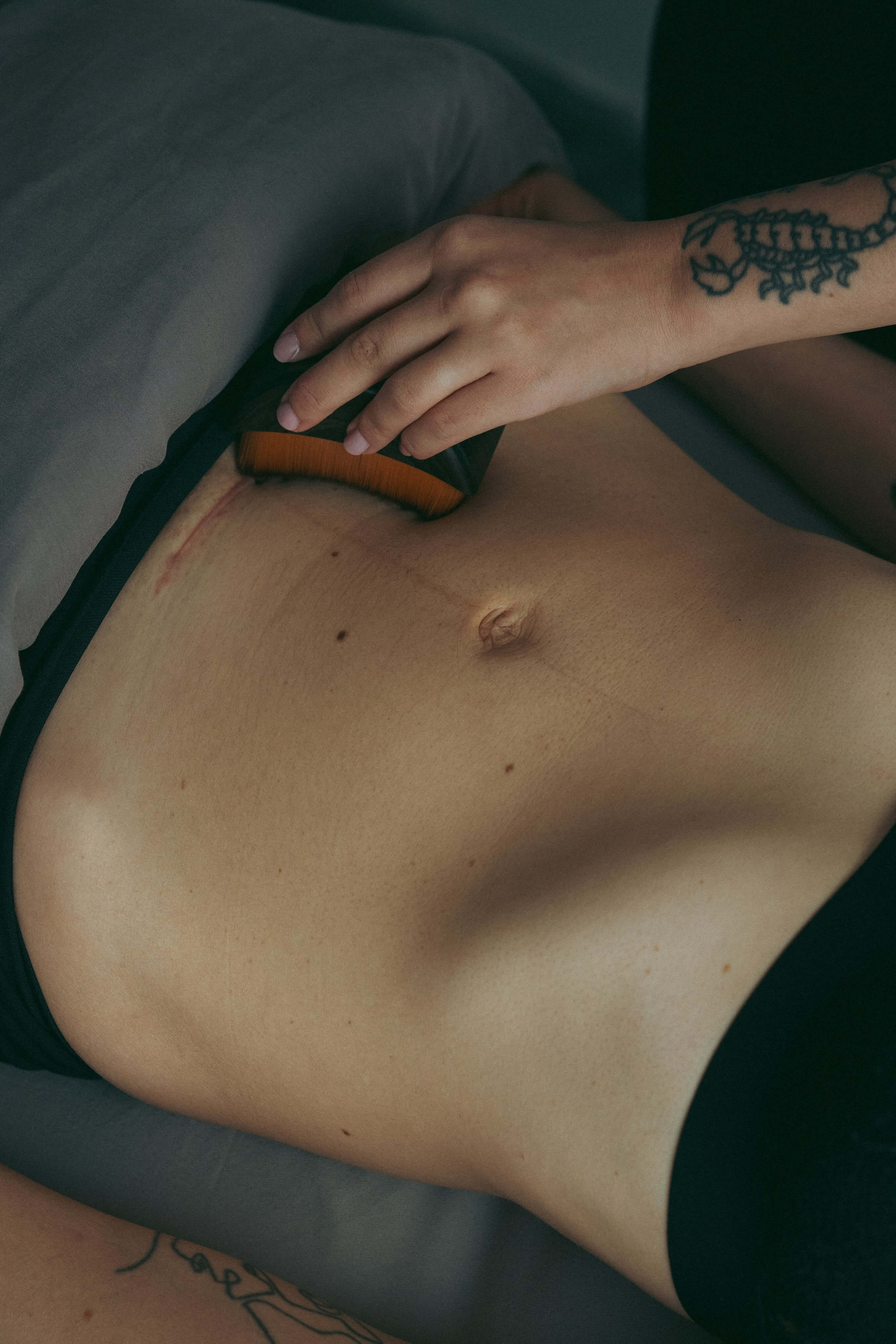 Une mère recevant un soin de la cicatrice de césarienne.
