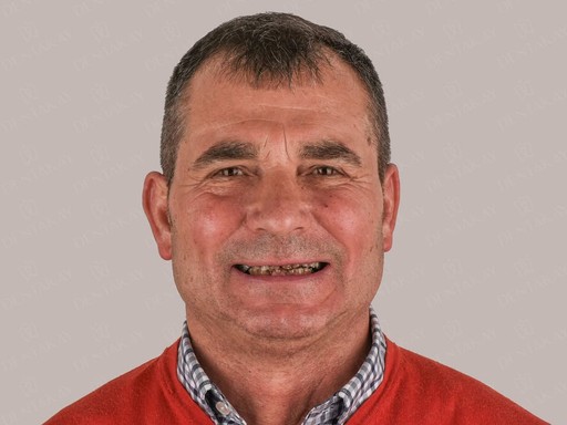 Zufriedener Patient mit neuem, ästhetischem Lächeln