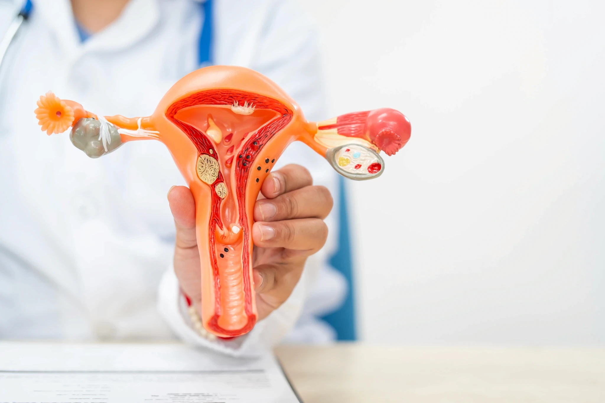 Doctor holding a detailed uterus and ovaries anatomical model