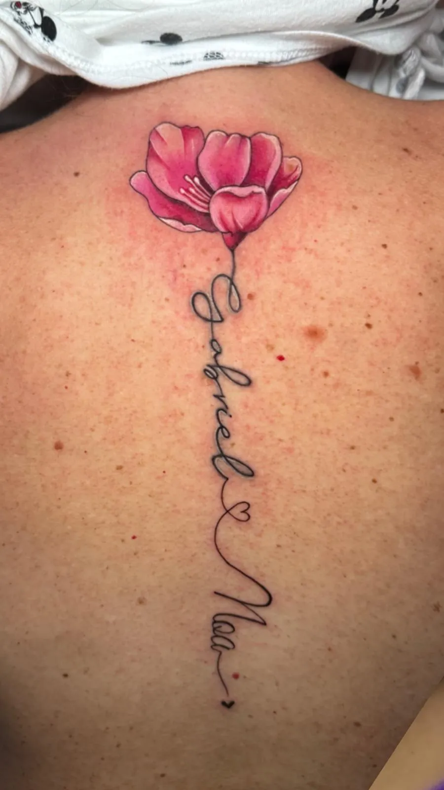 Láser para aclarar tatuaje antes de cover up en Móstoles