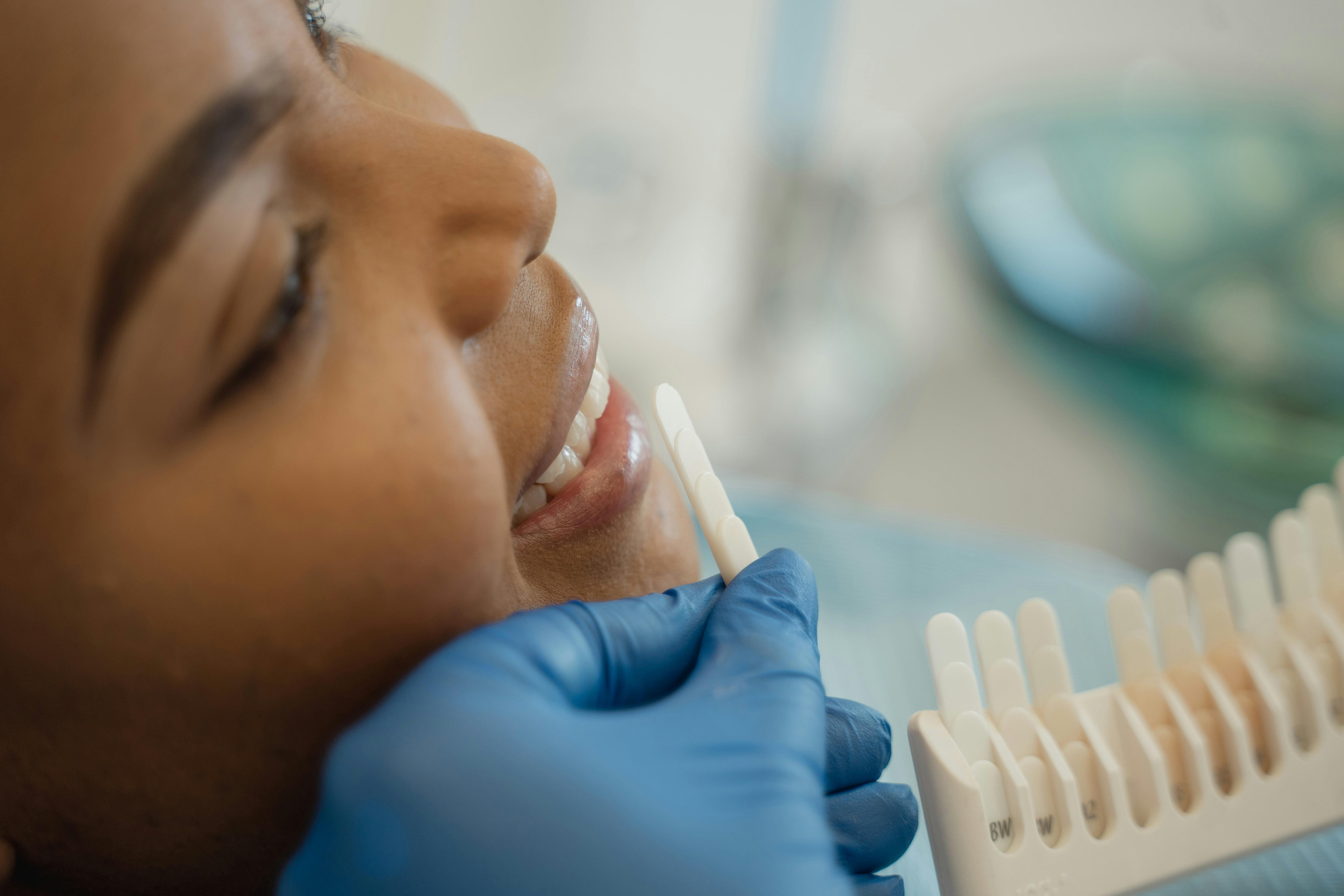 dental patient having teeth whiteness assesses