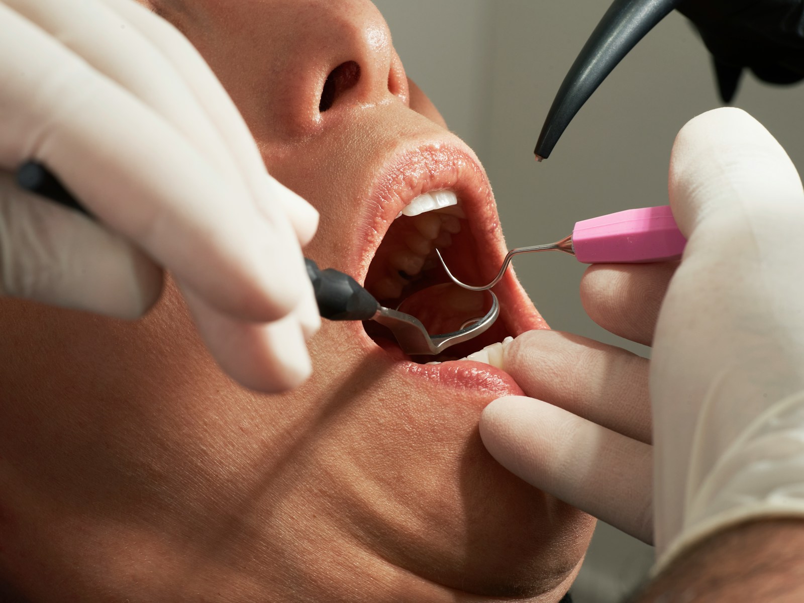 Patient receiving professional dental care