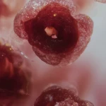 Early-stage cancers icon: abstract medical illustration representing early cancer detection