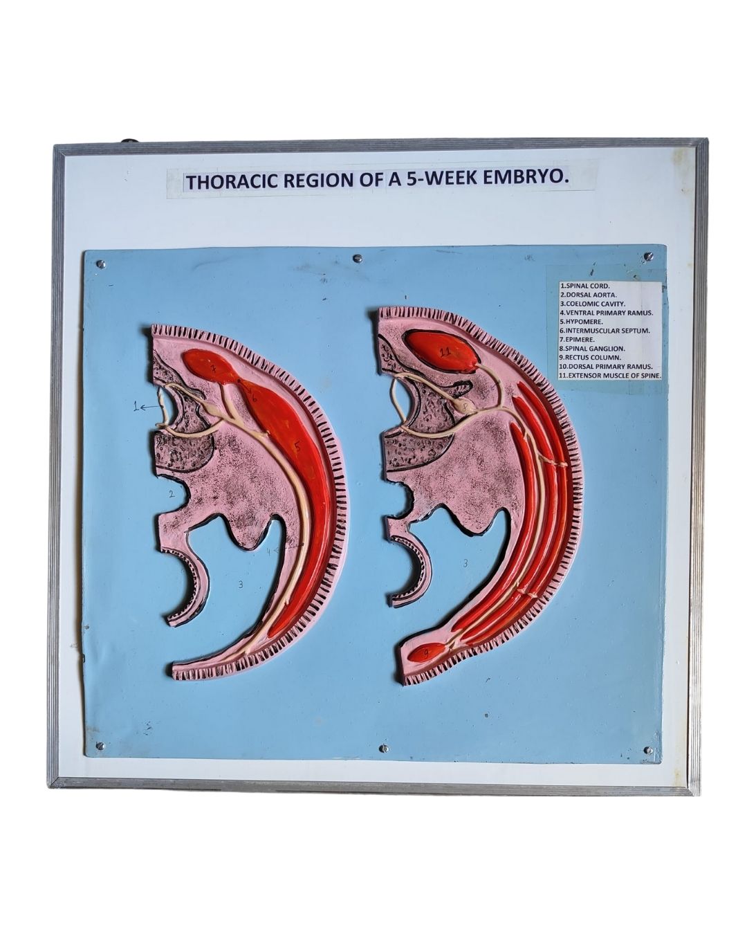 Thoracic Region of a 5-Week Embryo