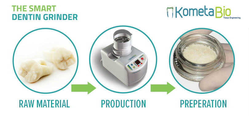 De werkwijze van de smart grinder