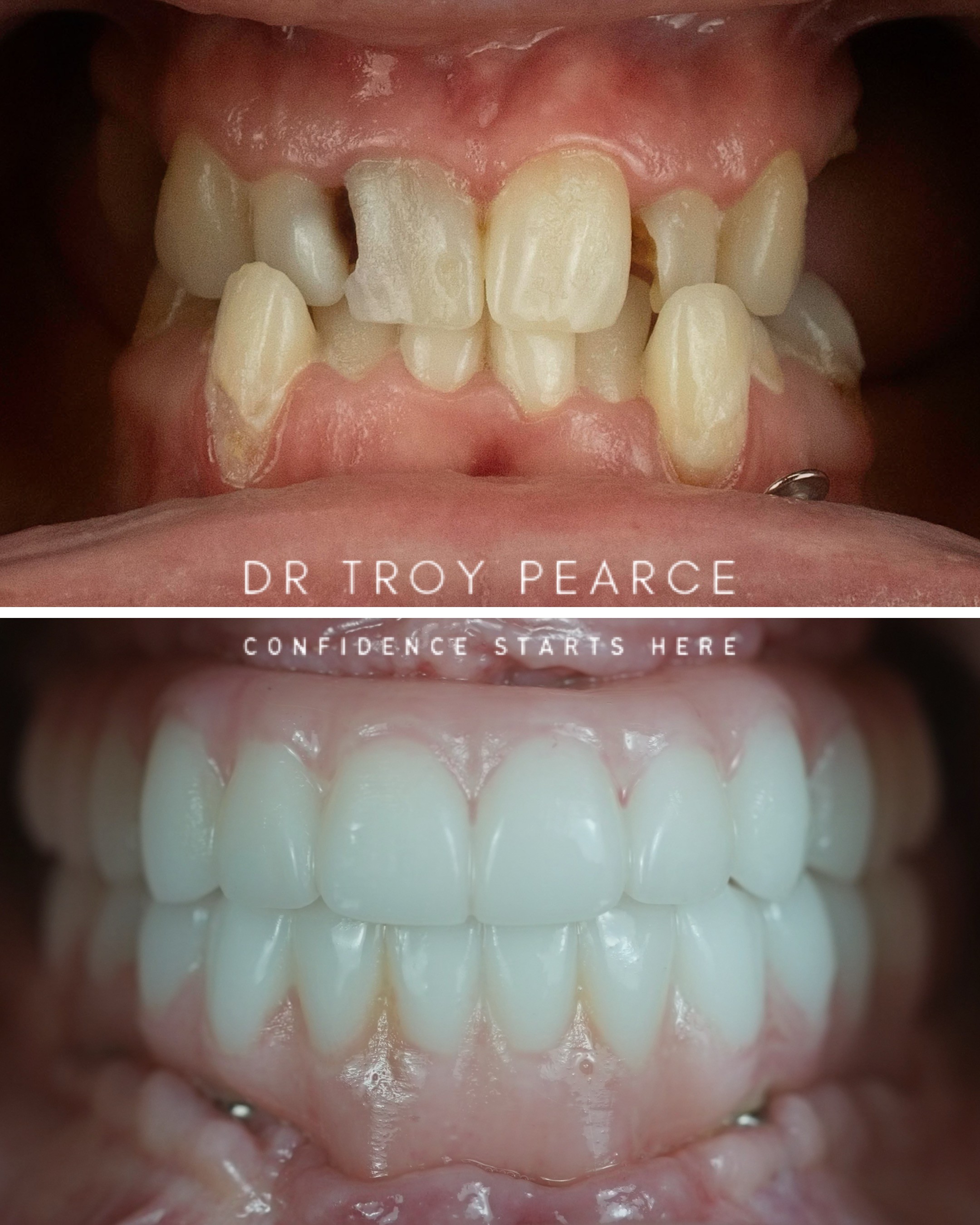 patient after before