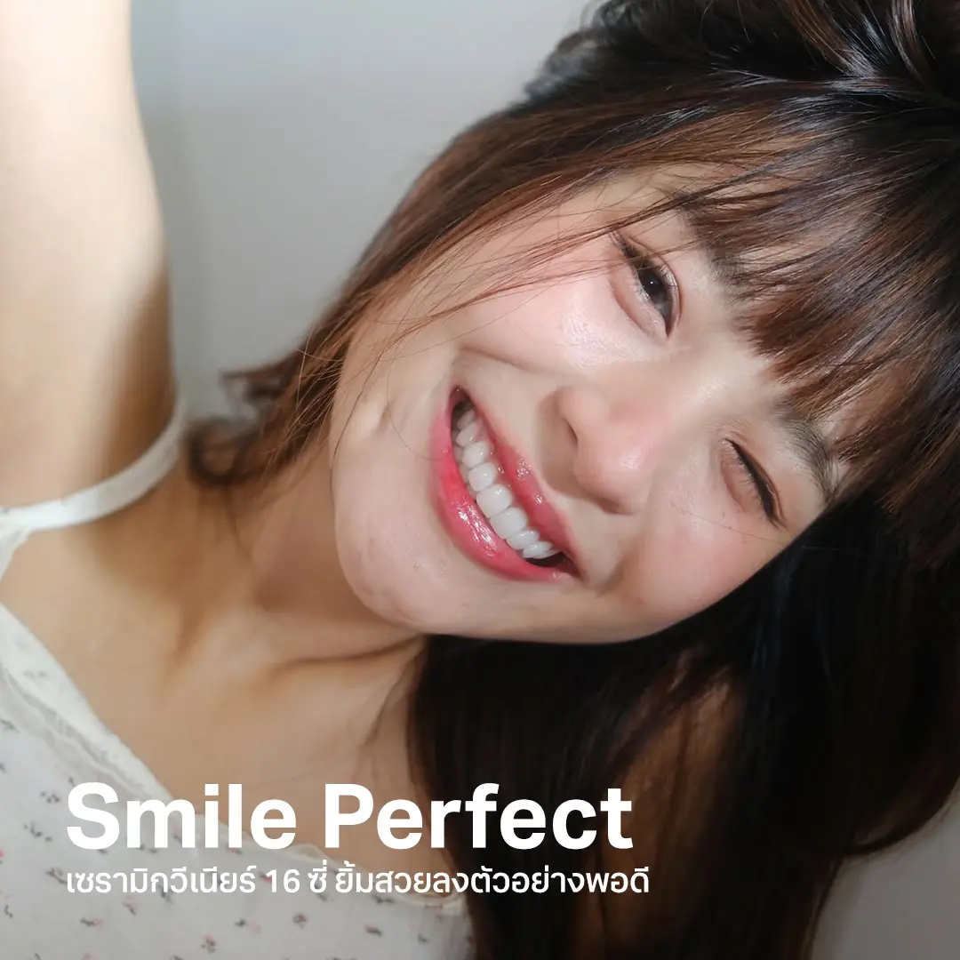 smile perfect โปรโมชั่น วีเนียร์ 2025 ราคาเท่าไหร่ cosdent smile designsmile perfect โปรโมชั่น วีเนียร์ 2025 ราคาเท่าไหร่ cosdent smile design