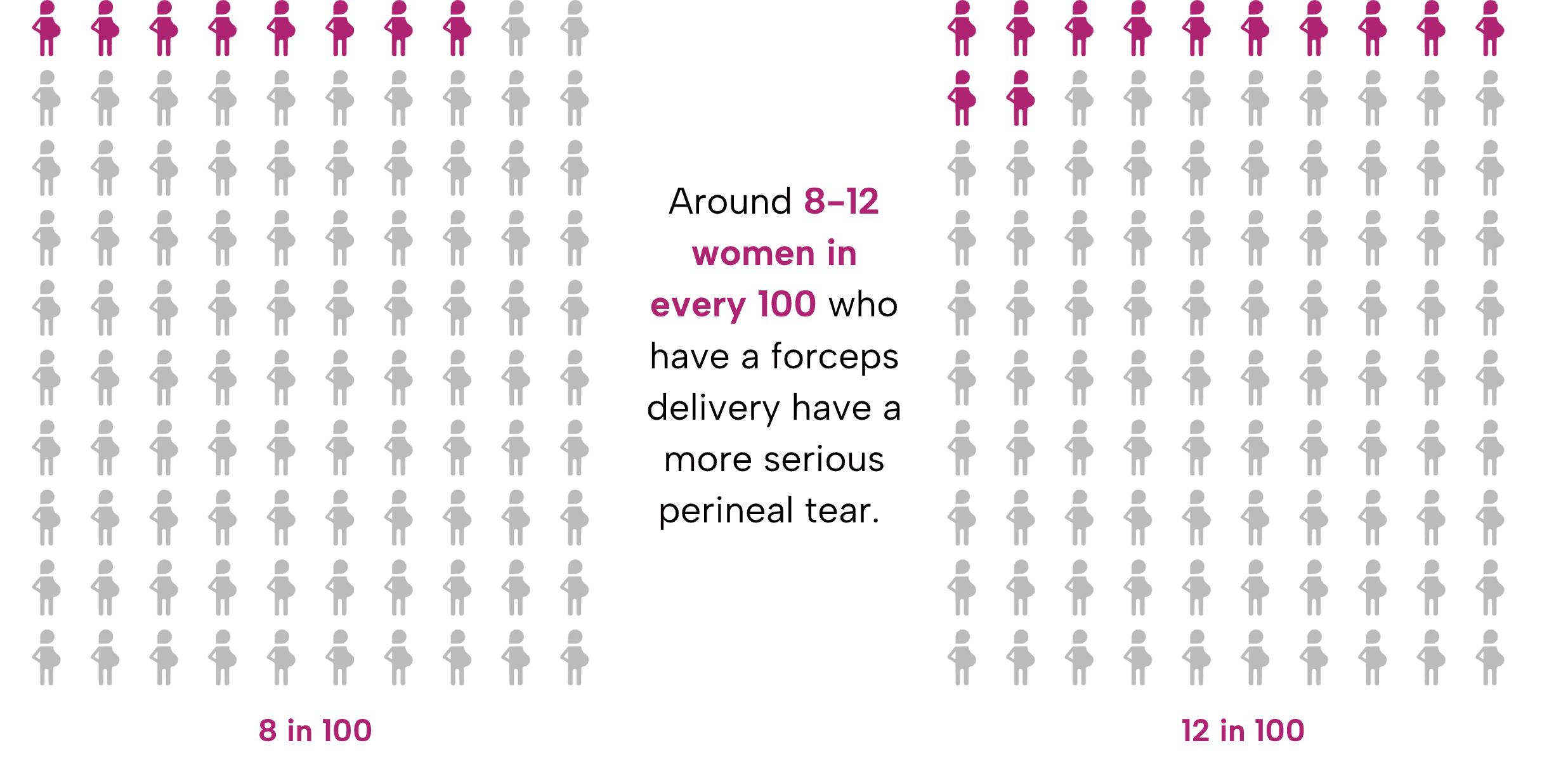 Comparative array diagrams showing 8-12 in 100 pregnant women of 100 filled in - around 8-12 in 100 women who have a forceps delivery have a more serious perineal tear.