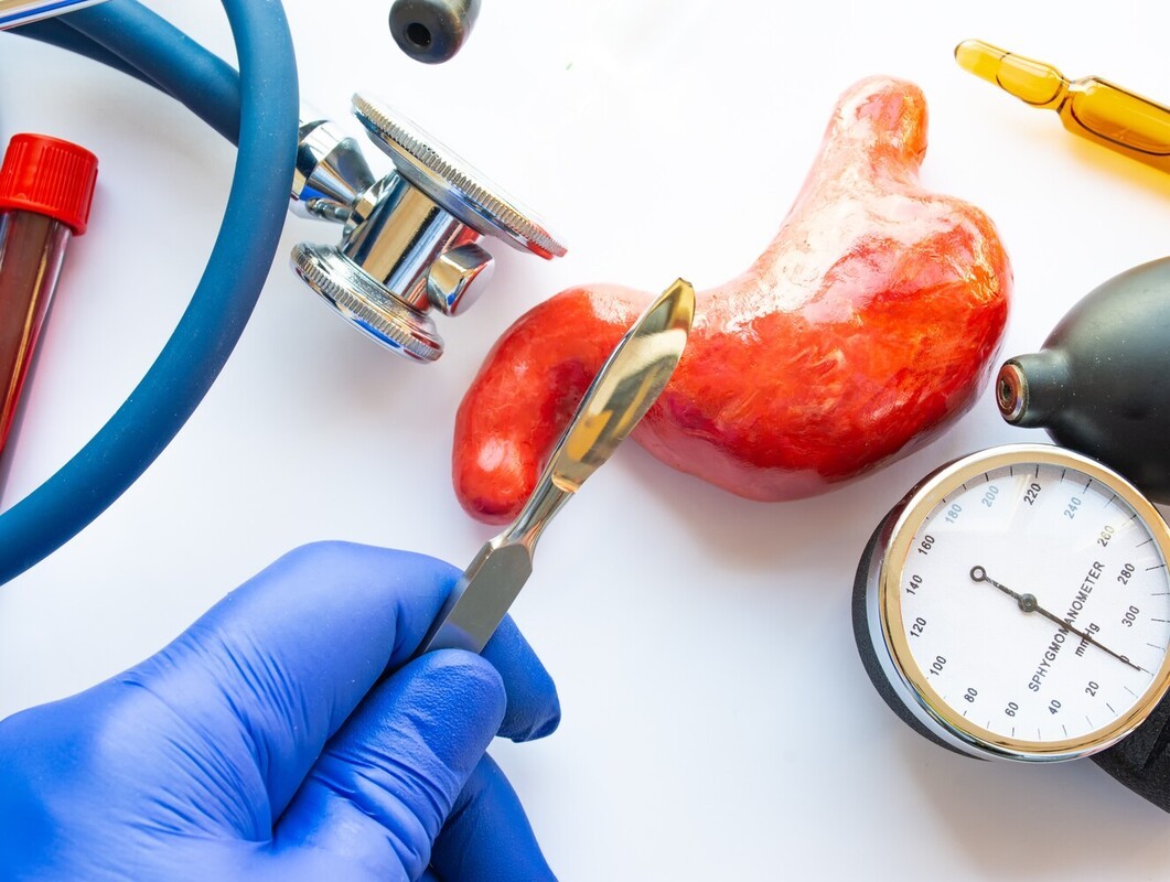 types of weight loss surgery