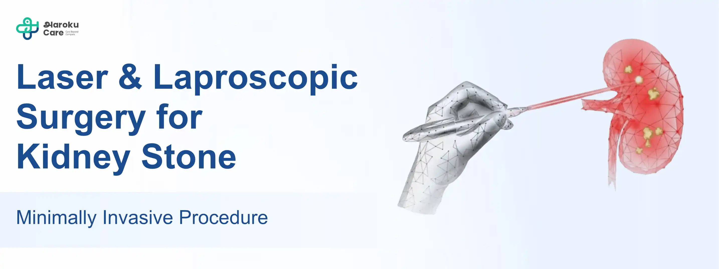 Diagram explaining excess gland and fat tissue in gynecomastia